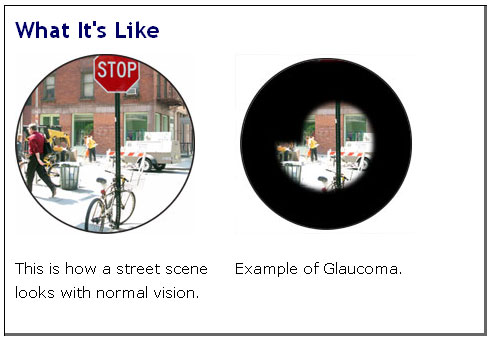 Image of what a person would see with 20/20 vision, image of what a person sees with glaucoma