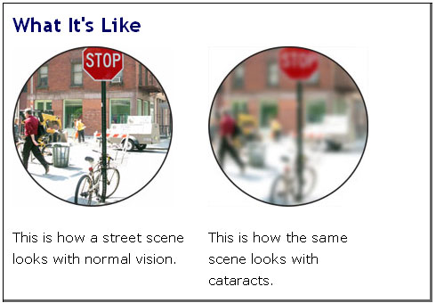 Image of what a person would see with 20/20 vision, image of what a person sees with cataracts