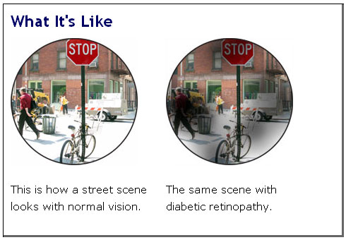 Image of what a person sees with 20/20 vision, image of what a person with diabetic retinopathy sees